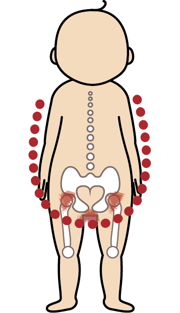 不舒適的脊椎 ＆ 髖關節位置2